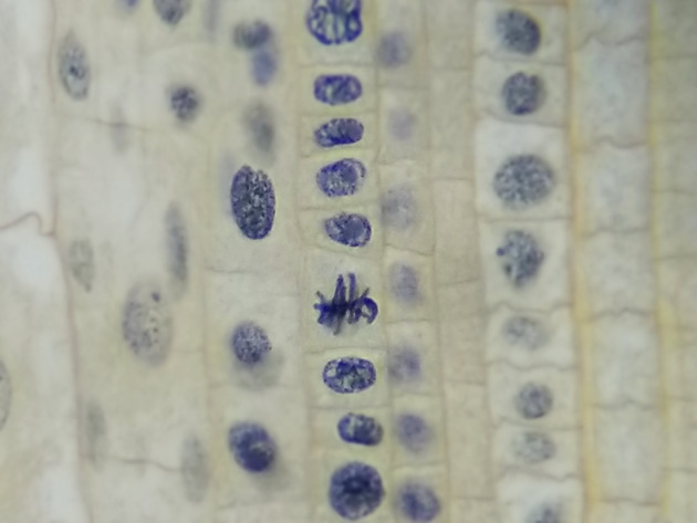 Onion Root Mitosis Slides - Onion Root  Mitosis  05 400X